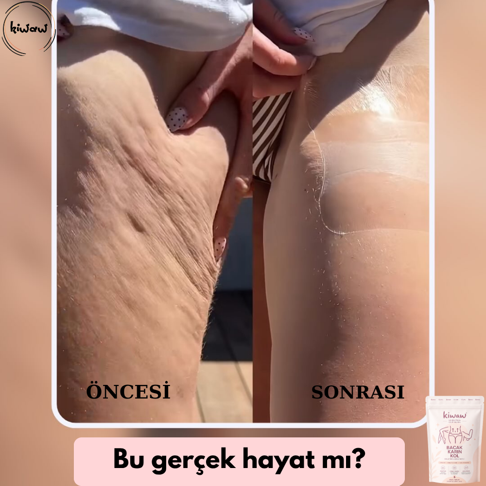 Kiwaw Selülit bandı