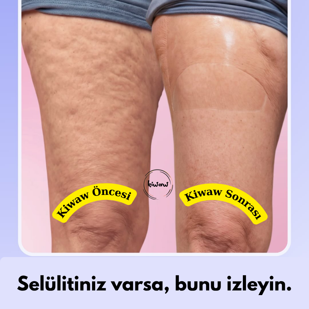 Kiwaw Selülit bandı
