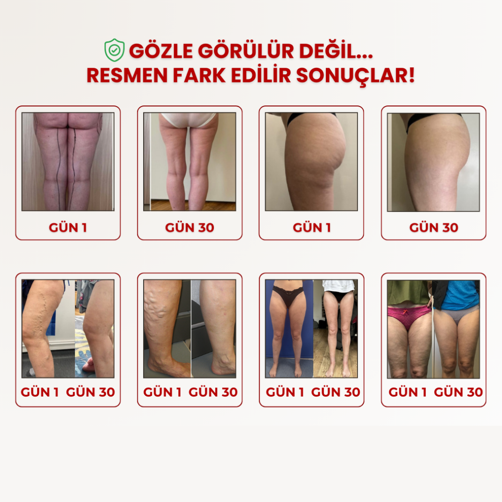 Kiwaw Selülit bandı