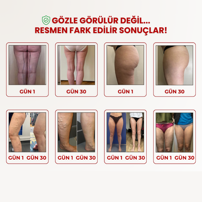 Kiwaw Selülit bandı