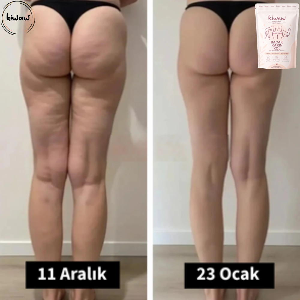 Kiwaw Selülit bandı