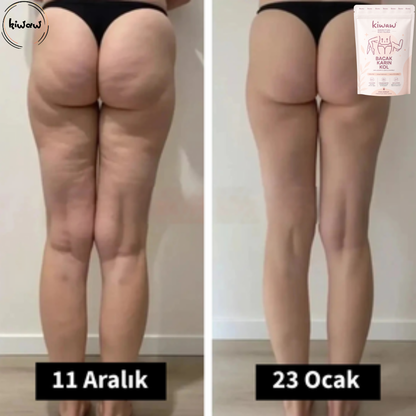 Kiwaw Selülit bandı