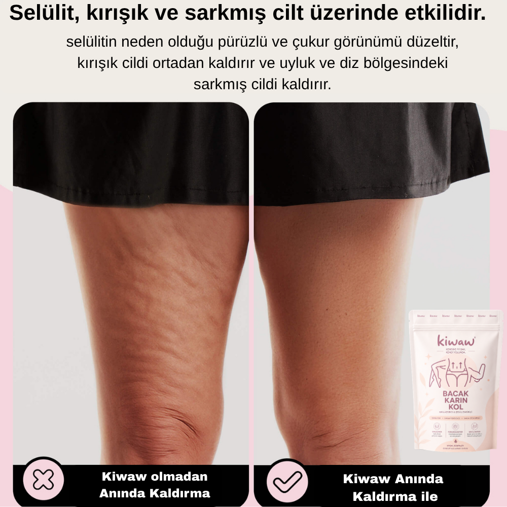 Kiwaw Selülit bandı