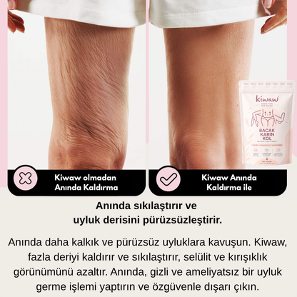 Kiwaw Selülit bandı